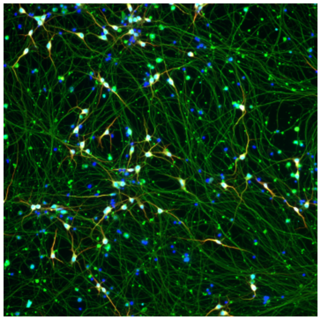 Fluorescence microscopy of the laboratory’s induced neurons